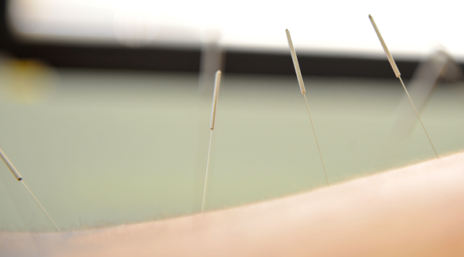 Acupuncture Boca Raton